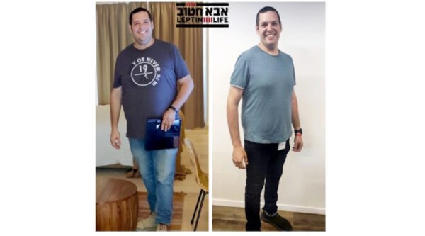 אכילה רגשית