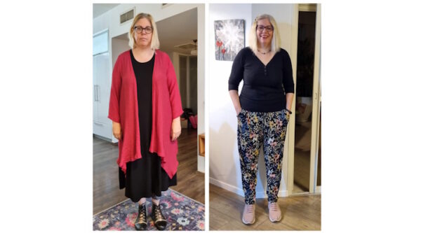 תנגודת אינסולין והשיטה הלפטינית